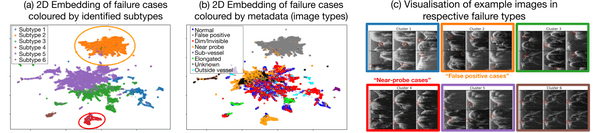 Figure from the paper: inspection of failure cases for catheter detection